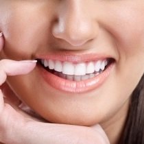 Dental teeth straightening