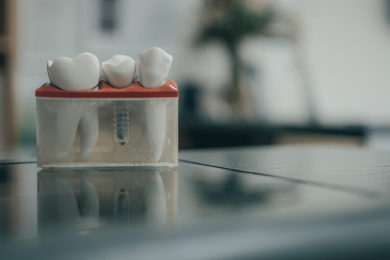 Dental implant model shown to a patient in Northwich